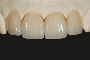 bột sứ- cuộc chơi sác màu-1